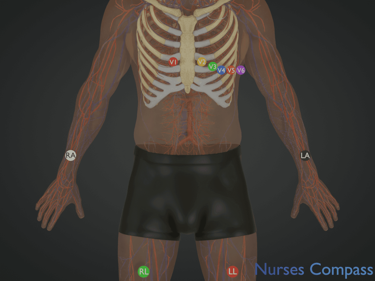 Anterior view showing standard 12-lead EKG electrode placement (limb leads and precordial V1–V6)
