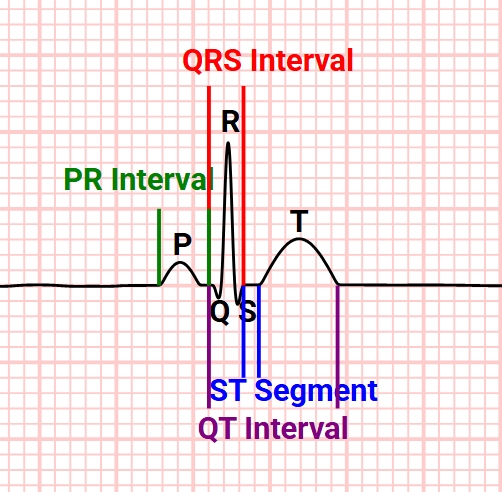 EKG Waves and Intervals Diagram