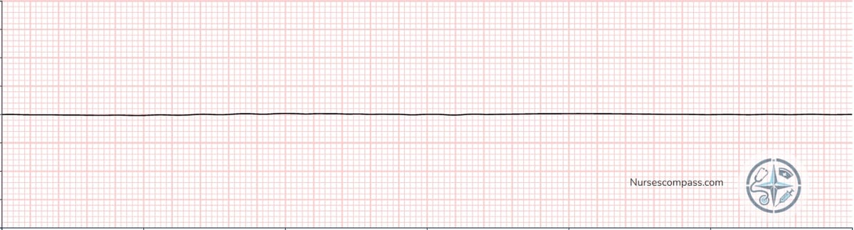 Asystole EKG Strip