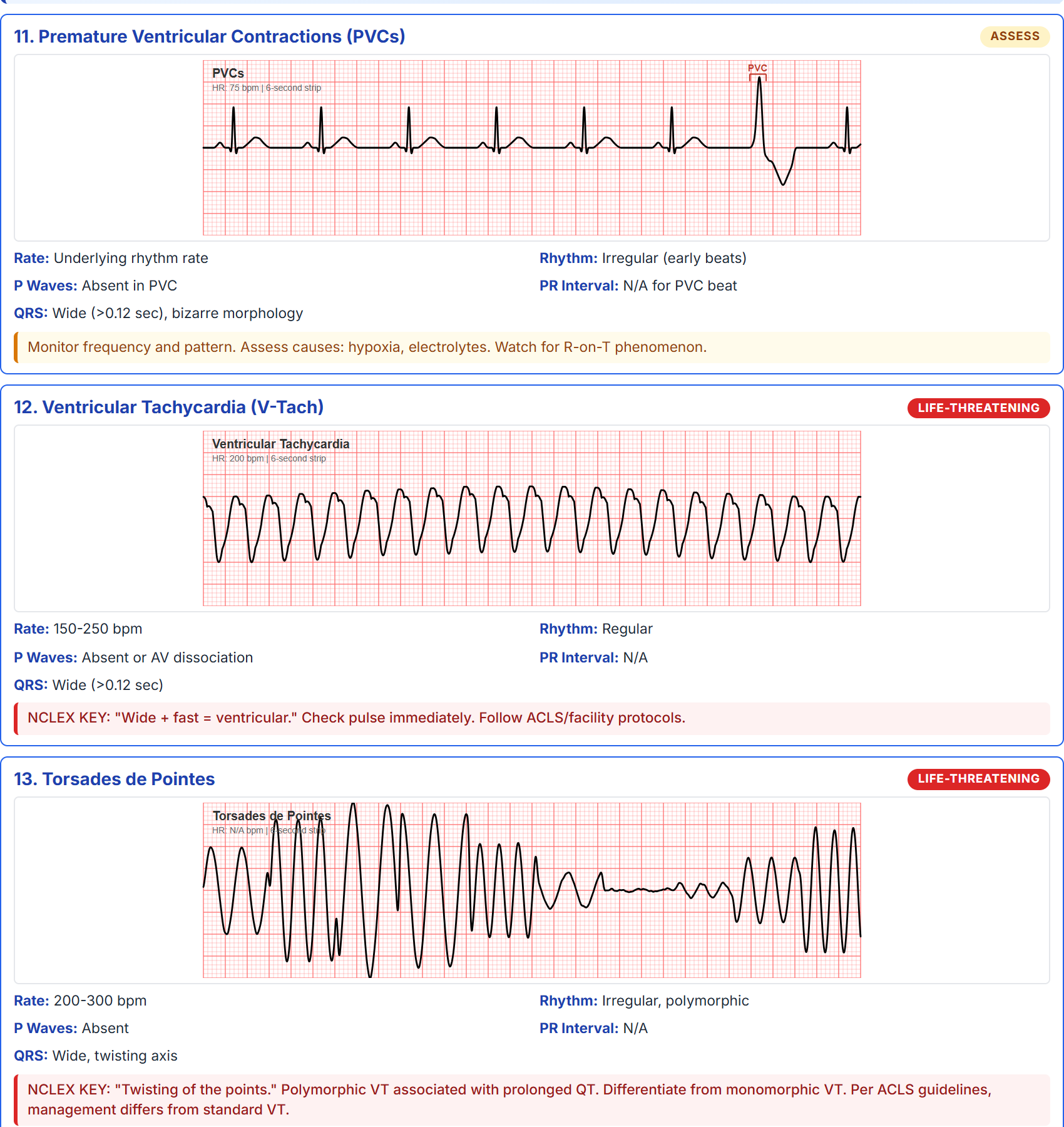 EKG Cheat Sheet preview showing rhythm strips with rate, rhythm, P wave, PR interval, and QRS data for each rhythm