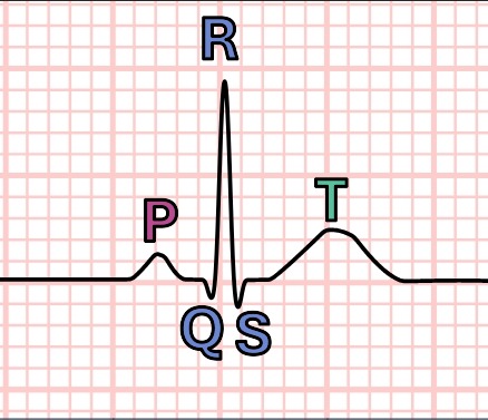 Complete PQRST Waves Reference Diagram